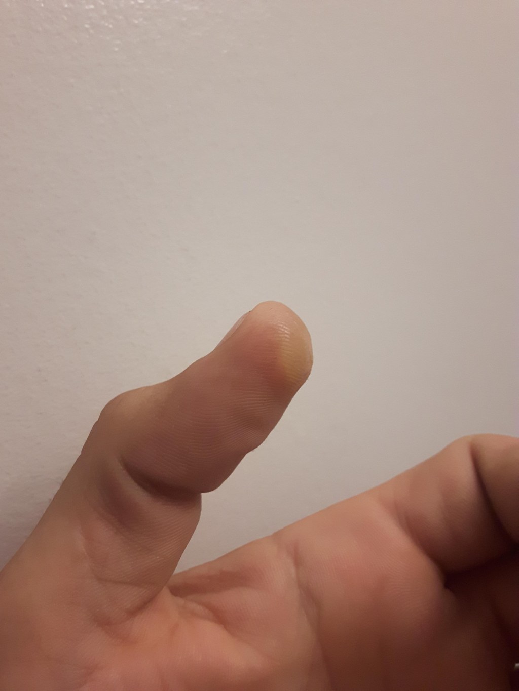 Picture of: My gaming callus after  years : r/mildlyinteresting